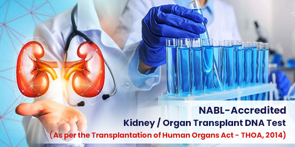 Dna Test For Liver Transplant
