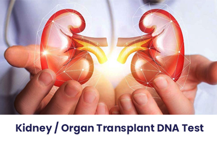 Kidney Organ Transplant DNA Test